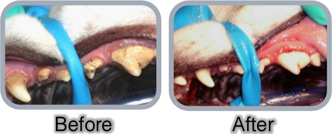 dental before_after